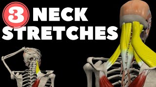 Neck Stretches for Instant pain relief [upl. by Sivaj]