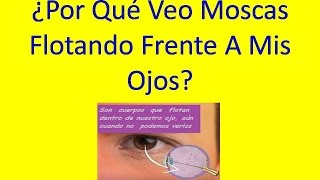 Por Qué Veo Moscas Flotando Frente a Mis Ojos  Objetos Flotantes Frente a Mis Ojos [upl. by Brace]