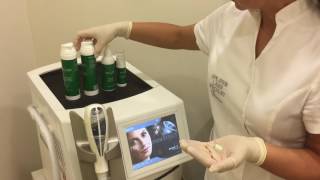 Epilazione Laser braccio con MedioStar Next [upl. by Leonteen]