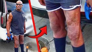 WTF Happened to Ronnie Colemans Legs [upl. by Su107]