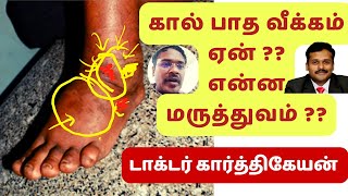 foot swelling treatment in tamil  dr karthikeyandiabetes  கால் வீக்கம் எதனால் ஏற்படுகிறது [upl. by Boot]