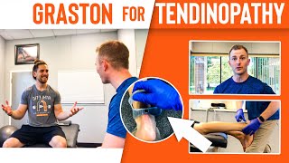 Tendinopathy Graston Technique on Achilles [upl. by Horgan163]