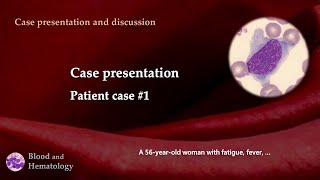 Patient case presentation case 1 [upl. by Avid]