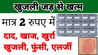 cetirizine tablet  cetirizine tablet uses in hindi  खुजली की गोली [upl. by Zenda183]