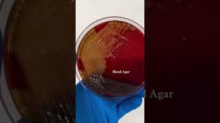 Microbiologie hospital تعلم pharmacist اكسبلور medicalstudent doctor algerie [upl. by Aerdua673]