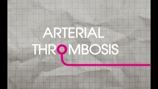 Arterial Thrombosis Explained [upl. by Aehsel]