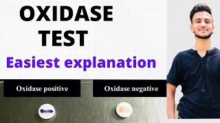 OXIDASE TEST  OXIDASE TEST MICROBIOLOGY [upl. by Gilson801]