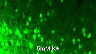 Improved adult brain slice method Ca imaging cortexwmv [upl. by Suitangi]