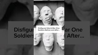 Disfigured World War One Soldiers Before and After Part 2 ww1 warshorts beforeandafter [upl. by Giliane]