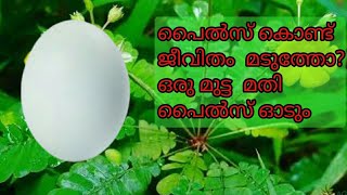 പൈൽസ് മാറാൻ ഏഴു ദിവസം മതി piles treatment at home in malayalambleeding piles remedy [upl. by Naitsyrk]