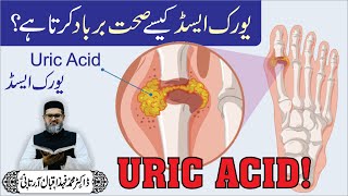 Uric Acid COMPLETE TREATMENT  Dr Fahad Artani Roshniwala [upl. by Ludly]