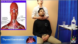 Mayo Medics Thyroid Examination [upl. by Nelyt]