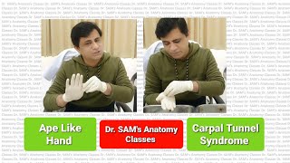 Carpal Tunnel Syndrome Anatomy  Ape Like Hand Deformity  CTS Demonstration on Gross Specimen [upl. by Llirrem311]