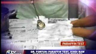 TVP Paraffin Test hindi raw mapagkakatiwalaan ang resulta  Dr Fortun 04172009 [upl. by Llien]