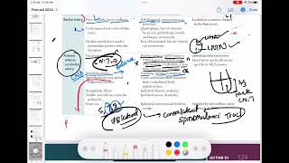 Anterior inferior cerebral artery stroke neurology 76  First Aid USMLE Step 1 in UrduHindi [upl. by Ellebana]