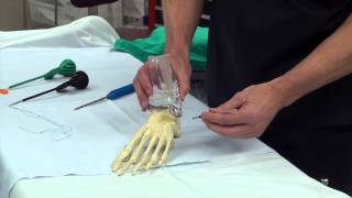 Dr Moore Explains Ankle Ligament Repair and Reinforcement Using the Arthrex Internal Brace [upl. by Besse]