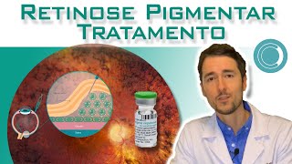 Retinose Pigmentar  tratamento com terapia gênica [upl. by Draner]