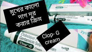 Clop G cream এর ব্যবহার মুখের কালো দাগ দূর করার ক্রিম tok forsa houyar cream clop G [upl. by Ilak]