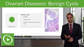 Ovarian Diseases Benign Cysts – Pathology  Lecturio [upl. by Fidole]