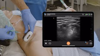 Preop POCUS of the Diaphragm Lung and Brachial Plexus [upl. by Lusar]