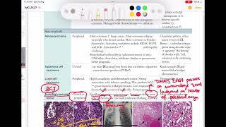 Bronchial Carcinoid tumor Respiratory 56  First Aid USMLE Step 1 in UrduHindi [upl. by Monarski475]