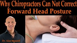 Why Chiropractors Can Not Correct Forward Head Posture  Dr Mandell Chiropractor [upl. by Onfroi574]