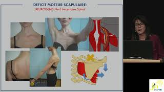 J2N 2018  Session  Myasthénie et myopathies [upl. by Uke]