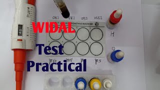 Widal Test Practical  Widal test for typhoid  Typhoid test in hindi  Typhoid ke liye test  विडाल [upl. by Chappy]