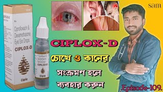 Ciplox D Eye Ear Drops❓Ciprofloxacin Dexamethasone Eye Ear Drops❓Ciplox D Drops [upl. by Asim]