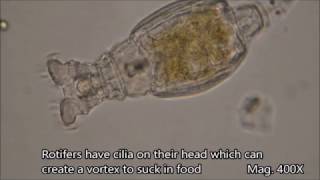 Rotifers under the microscope [upl. by Karine]