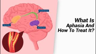 What Is Aphasia And How To Treat It [upl. by Asital269]