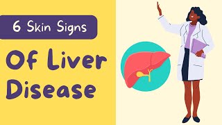 5 unexpected skin changes caused by liver disease  How your skin can reveal liver disease [upl. by Gault313]