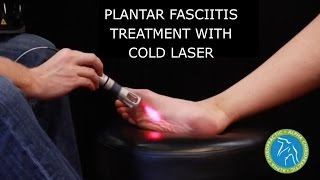 Plantar Fasciitis Treatment With Cold Laser [upl. by Klemperer]