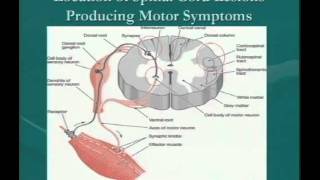 Clinical Significance of Demyelinating Lesions of the Central Nervous System [upl. by Ahsiet]