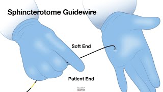 HCC 1474 12b Sphincterotome Guidewire [upl. by Anerul244]