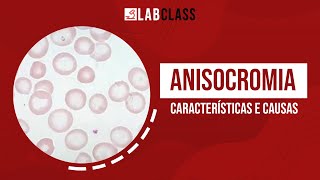 Anisocromia características e causas  Alterações no eritrograma [upl. by Sandye225]