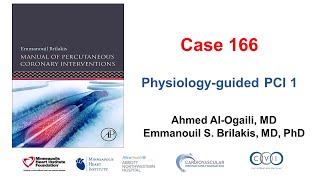 Case 166 Manual of PCI  Physiologyguided PCI 1 [upl. by Calista538]