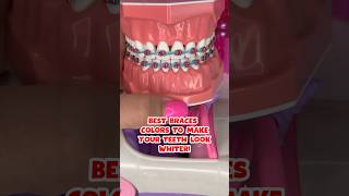 Best BRACES COLORS that make your TEETH LOOK WHITER 🦷 braces bracescolors shorts [upl. by Inez398]