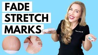 Fade Stretch Marks  Ingredients that WORK and the Science to Back it up [upl. by Keverne]