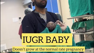 IUGR BABY doesn’t grow at the normal ate pregnancy  ankur maitrika hospital 🏥♥️ [upl. by Toulon]