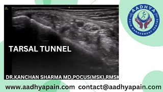 Ultrasound of the Tarsal Tunnel [upl. by Grantley]