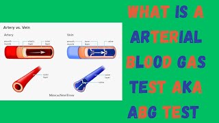 What is a arterial blood gas test AKA ABG TEST [upl. by Dollar]