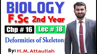 Deformities of skeleton  Chapter 16  2nd year Biology  Lec  18 [upl. by Megan930]