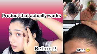 Finally a product that actually works  Solution to your hair problems 🥹❤️  SHEELOVE [upl. by Athallia]