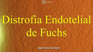 Distrofia Endotelial de Fuchs [upl. by Nohtan]