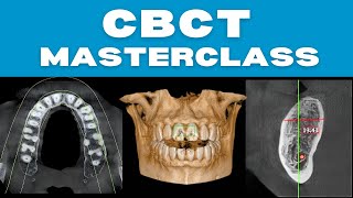 CBCT Masterclass With Real Case Discussions [upl. by Ahtnahc]