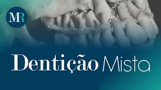 DENTIÇÃO MISTA DENTE DE LEITE  PERMANENTE l Mariana Rinaldi [upl. by Vig]