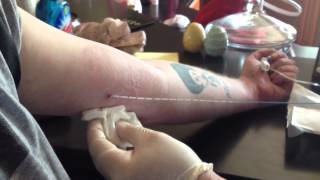 PICC Line Removal [upl. by Holli]