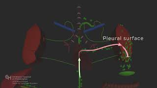 Chylothorax [upl. by Esma]