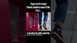 Pigeon Toed walking Intoeing baby walking  parents should be aware of shorts [upl. by Eenerb]